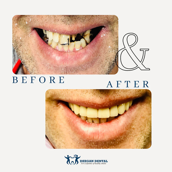 Prosthodontist in West Orange