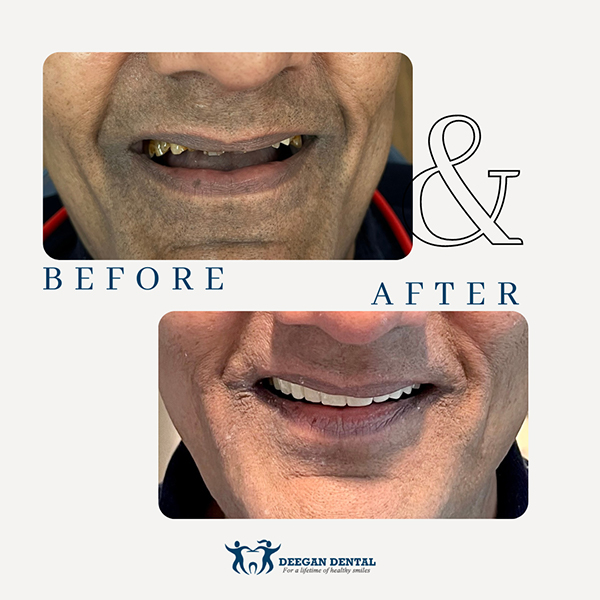 Prosthodontist in West Orange