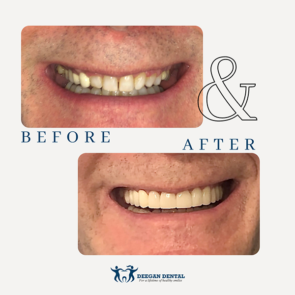 Prosthodontist in West Orange