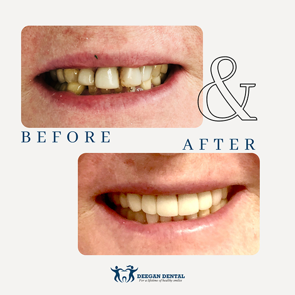 Prosthodontist in West Orange