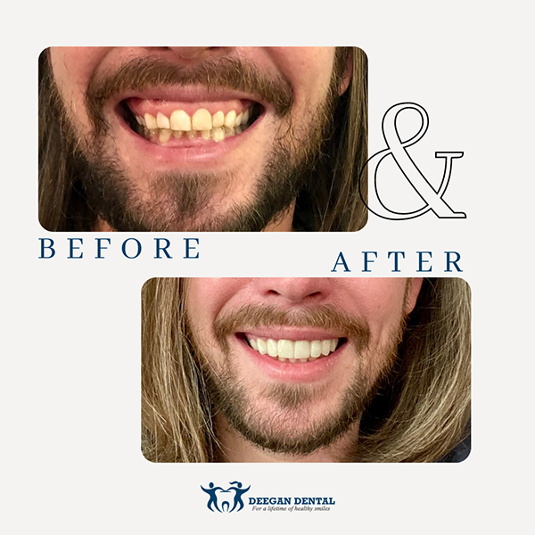 Prosthodontist in West Orange