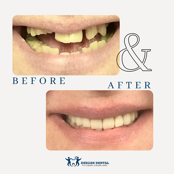 Prosthodontist in West Orange