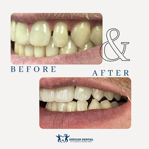 Prosthodontist in West Orange