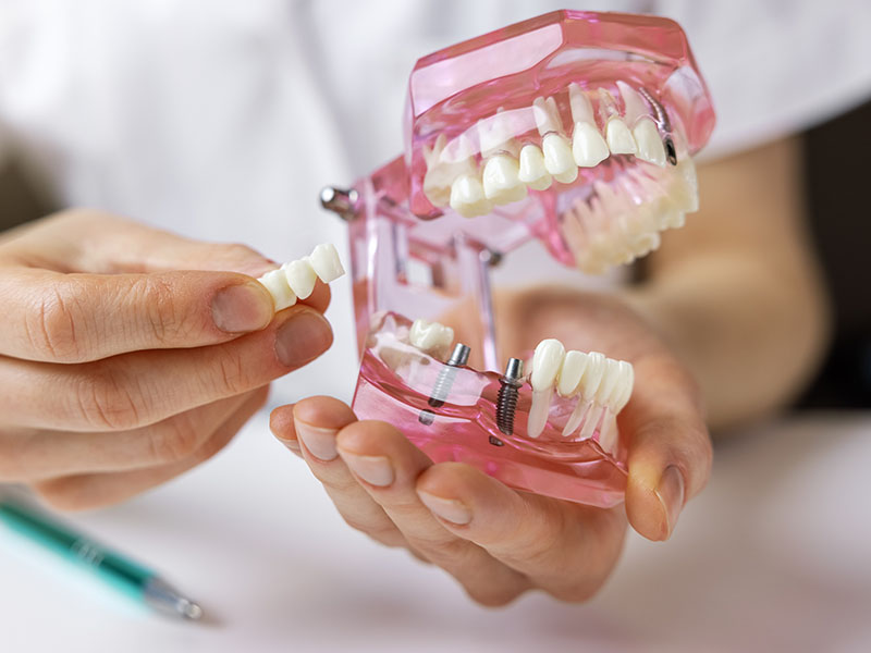 Prosthodontist in West Orange